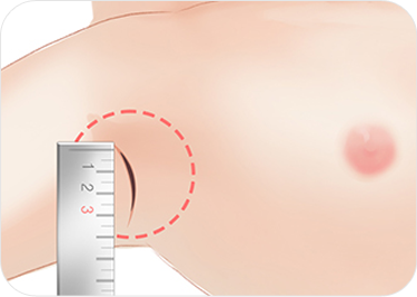 breast03 cont05 02