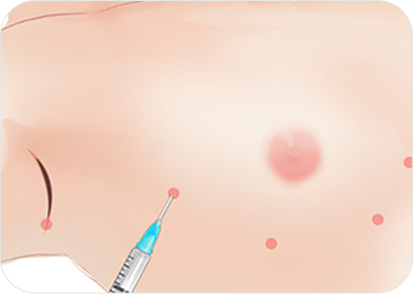 breast03 cont05 03