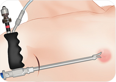 breast03 cont05 04