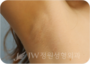 breast03 cont05 06