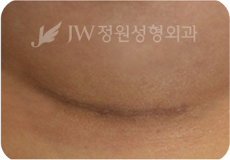 breast03 cont06 02