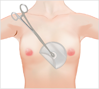 breast03 cont08 02