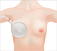 breast03 cont08 03