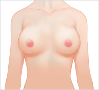 breast03 cont08 04
