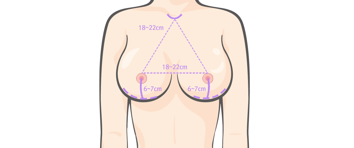 breast03 cont09