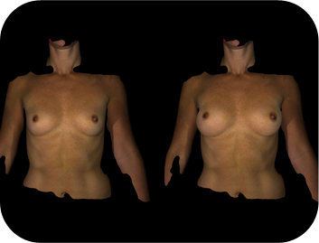 breast03 cont15 item03