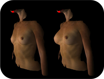 breast03 cont15 item04