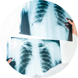 breast01 cont09 03