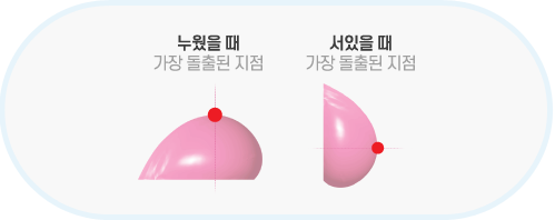 breast19 cont05 item02 03 1