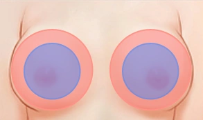 type 08