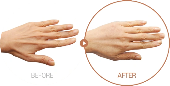 beforeafterimage