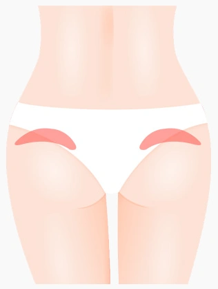 body001