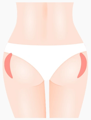 body003