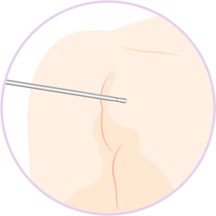 breast17 cont04 01