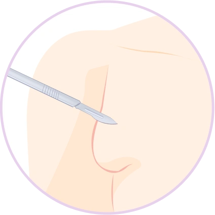 breast17 cont04 02