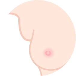 breast17 cont05 03