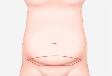 step21