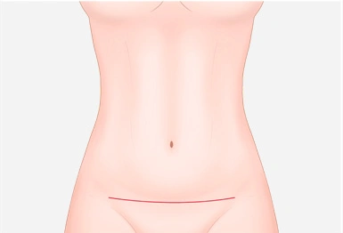 step23