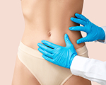 Abdominoplasty service