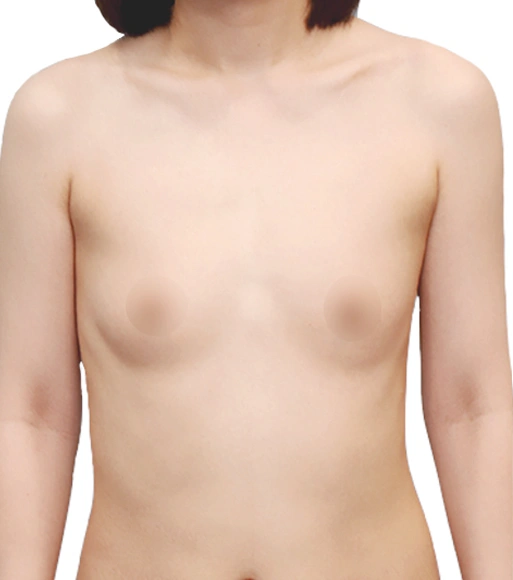 Before Image
