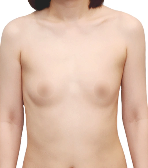 Before Image