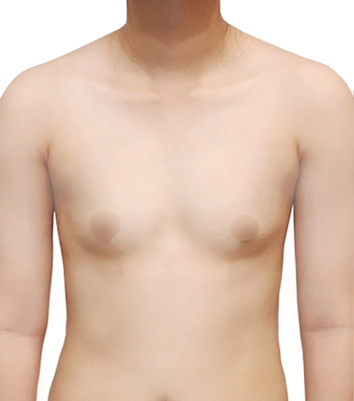 Before Image