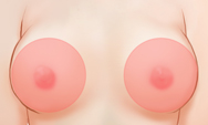 breast4 img1a
