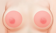 breast4 img1h